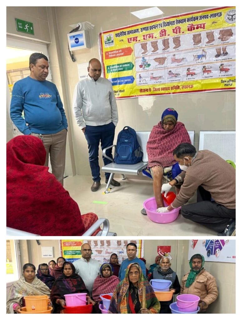 सरोजनीनगर सामुदायिक स्वास्थ्य केंद्र में फाईलेरिया रागियों हेतु मॉरबिटी मैनेजमेंट कैम्प का आयोजन